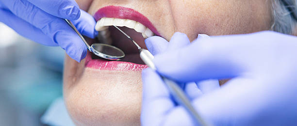 Best Knocked-Out Tooth (Avulsed Tooth) Treatment in Fox Crossing, WI